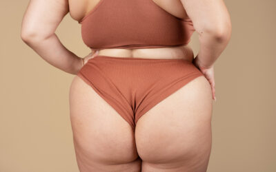 Alimentazione e Cellulite